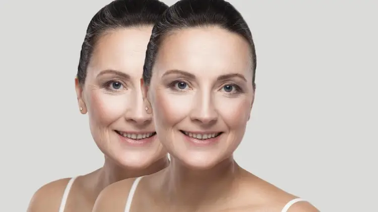 before and after skin wrinkles treatment